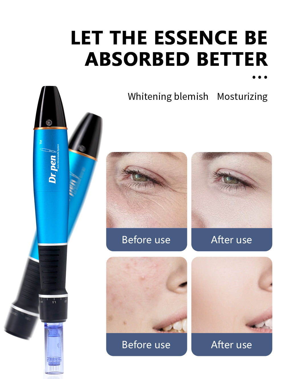Dr Pen Ultima A1 Microneedle Facial Care