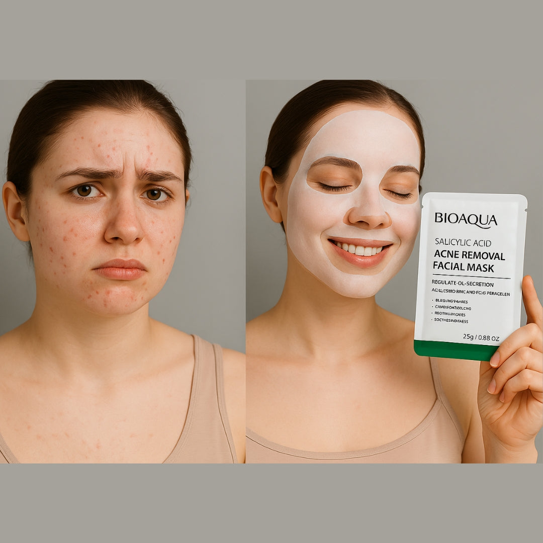 Salicylic Acid Acne Removal Facial Sheet Mask