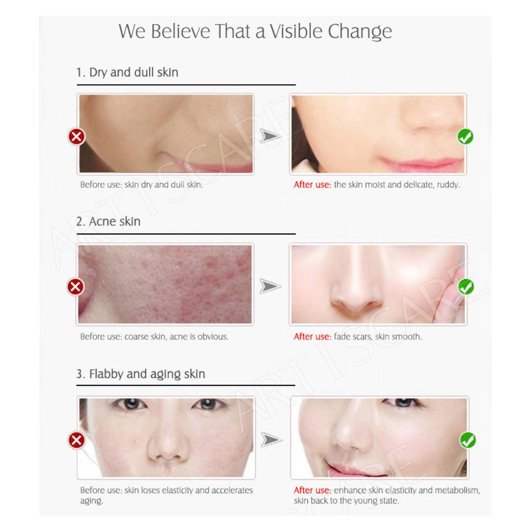 Vitamin C Serum Moisture Restoring – Whitening & Anti-Blemish